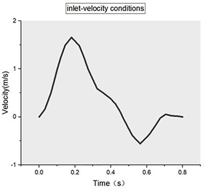 Impact of craniocervical junction abnormality on vertebral artery hemodynamics: based on computational fluid dynamics analysis